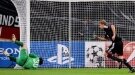 Kiessling brace in Bayer rout